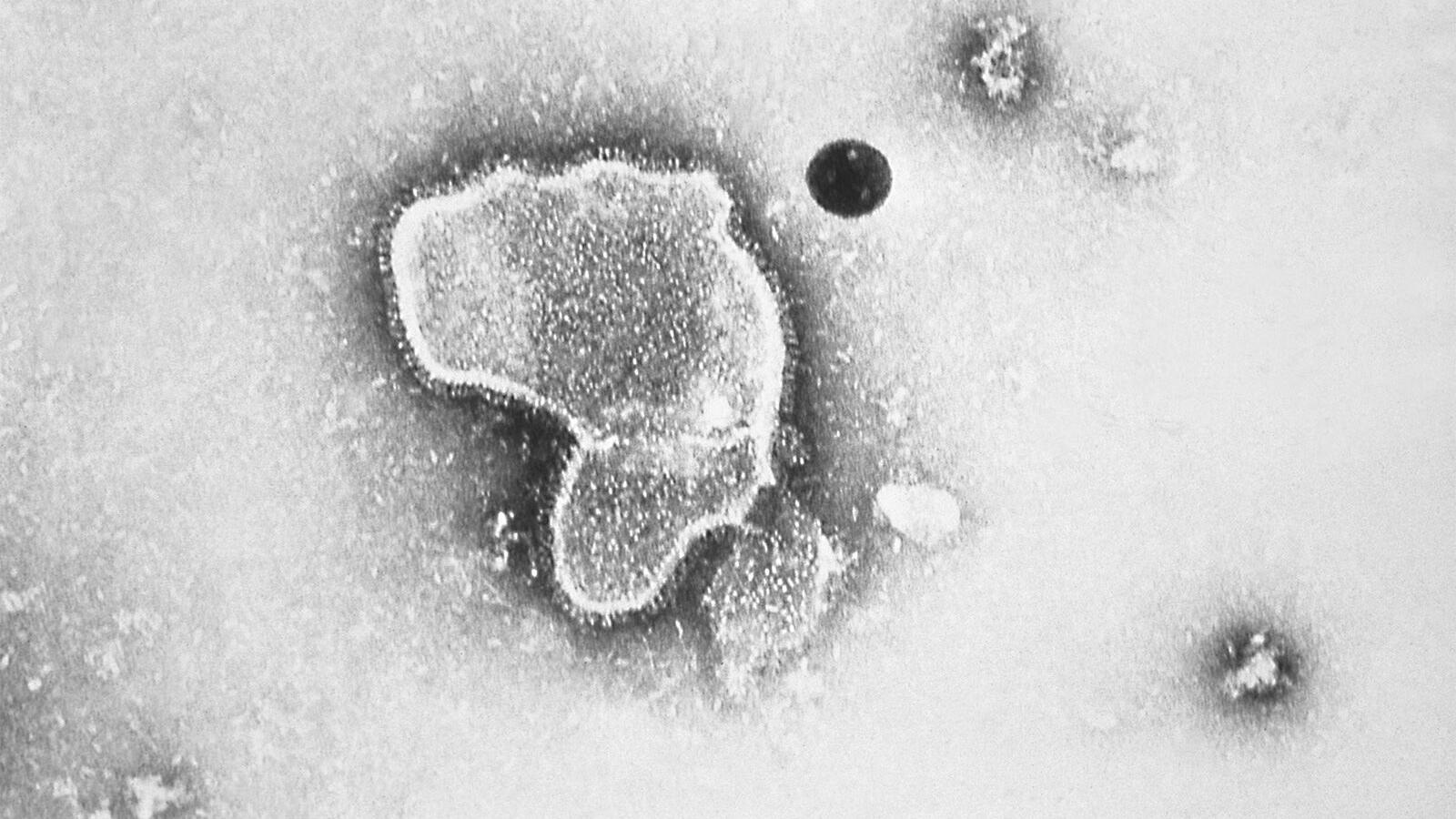 FDA approves first vaccine for RSV, a moment six decades in the making